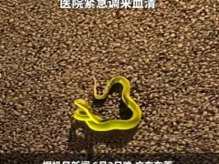 男子散步被青蛇咬伤后忍痛拍照 右脚大拇指被蛇咬伤！
