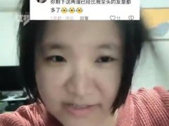 女子因发量太多剃掉五分之四头发 仅保留少量以维持基本发型！