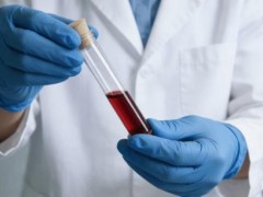 山东发现1例钻石血 比熊猫血更罕见 具体什么情况？